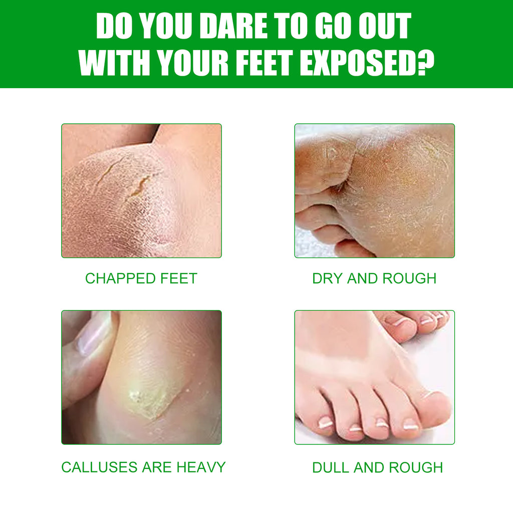 Aloe Vera Foot Mask, Moisturizing Anti-Cracking, Dead Skin Removal, Tender Skin Care Foot Mask