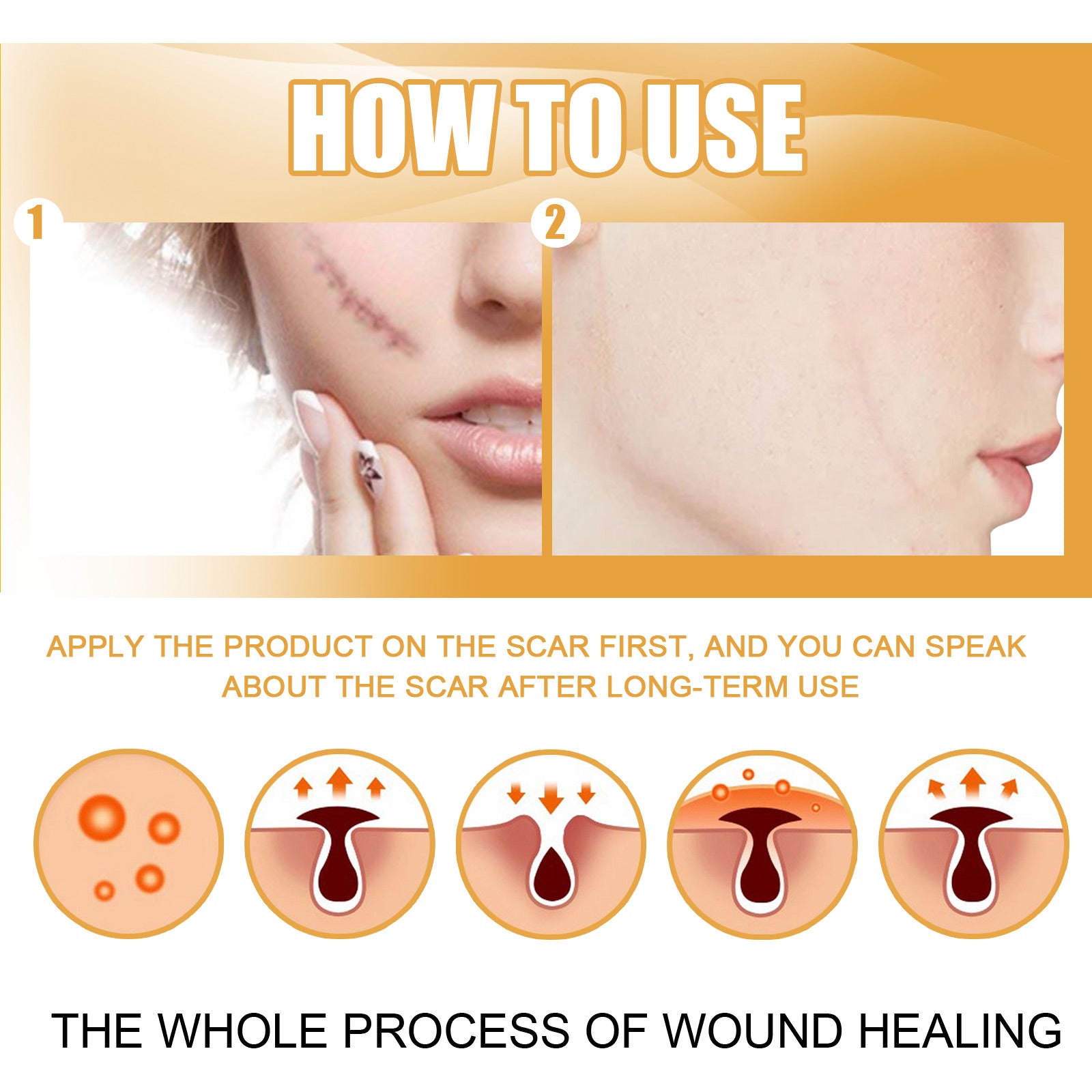 Desalting Skin Scar Cream, Skin Burn Scalding Surgical Scar Wound Repair Cream