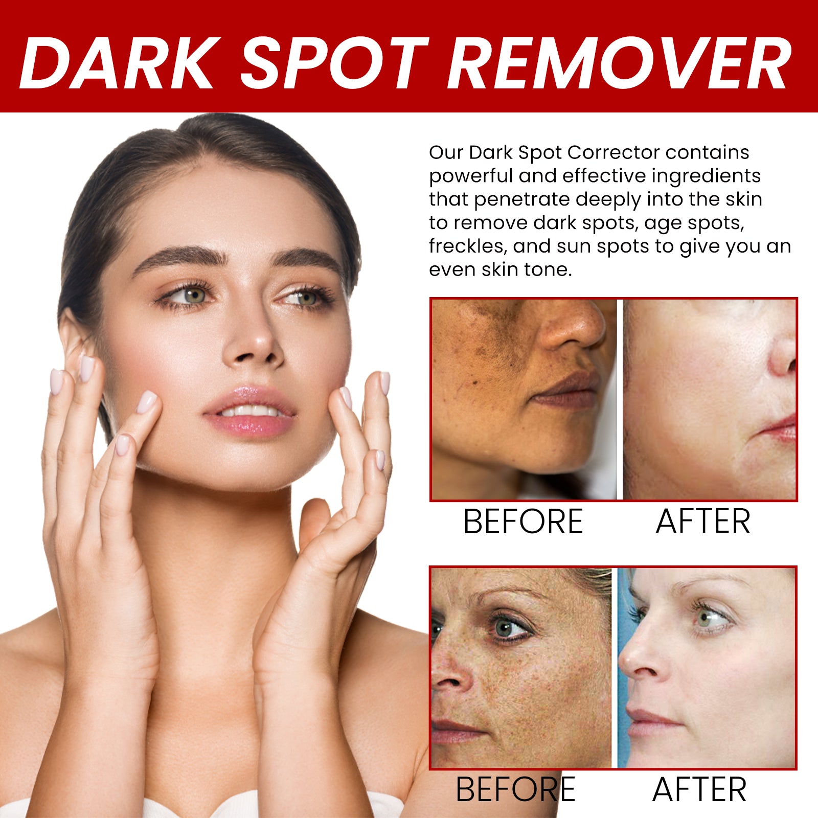 Dark Spot Removal Cream, Moisturizing Repair Lighten Face Fine Lines And Spots Skin Whitening Cream