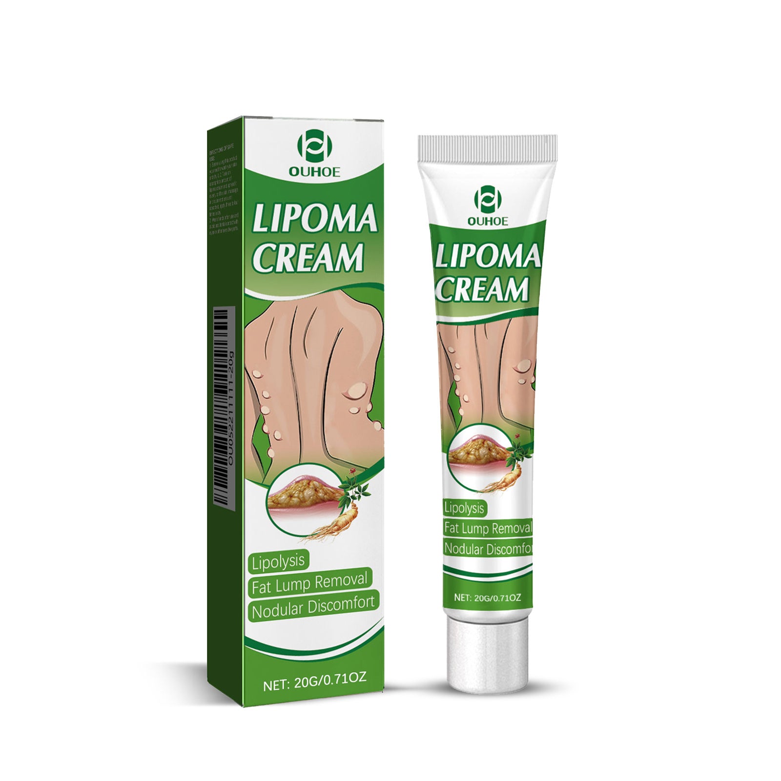 Fat Binding Cream, Dredge Body Of Many Kinds Of Fat Caking Tumor Subcutaneous Lumps Body Care Cream