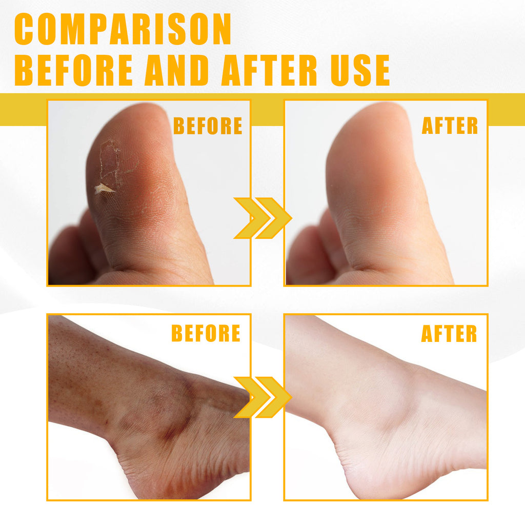 Yellow Exfoliating Oil, Brightening Skin, Moisturizing Whitening Beautify Skin And Body Exfoliating Oil