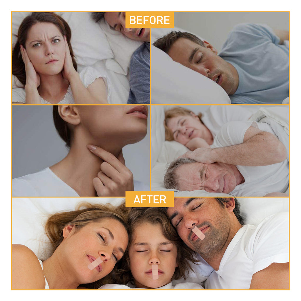 Anti-Snoring Patches, Improve Sleep And Prevent Snoring During Open Mouth Sleep For Adults At Night