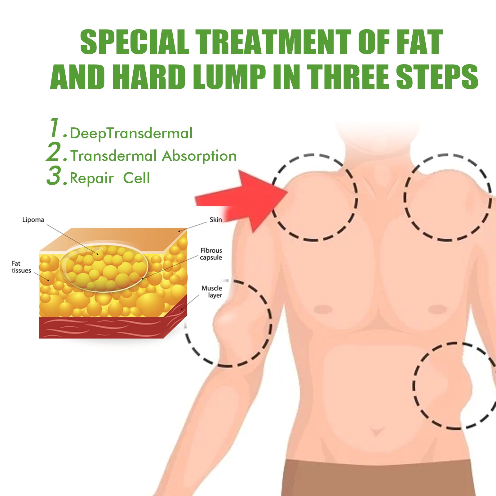 Fat Binding Cream, Dredge Body Of Many Kinds Of Fat Caking Tumor Subcutaneous Lumps Body Care Cream